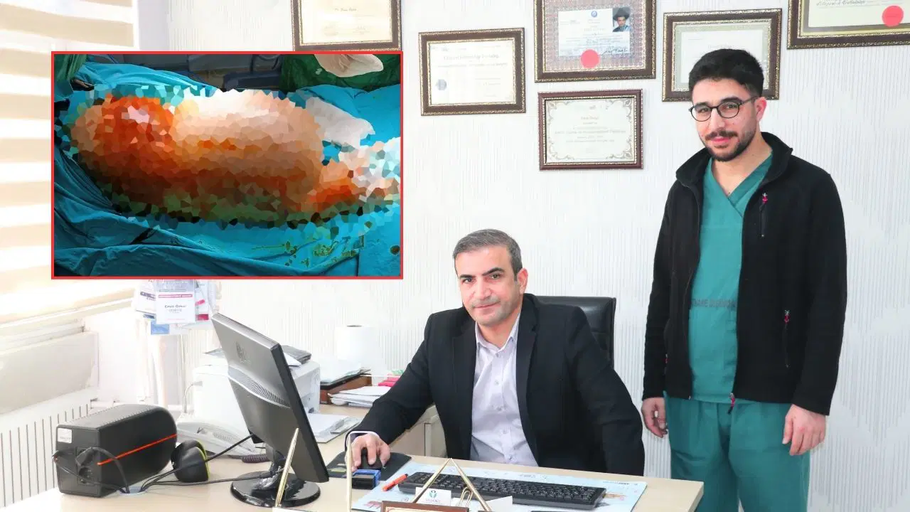 Doktorlar bile şaşırdı:Bacağından 5 kilo 668 gramlık kitle alındı