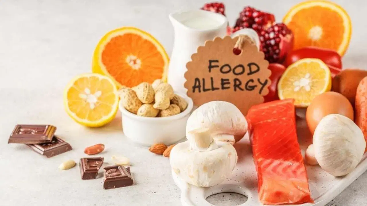 Besin alerjilerinde uzman uyarısı: Geç kalınan müdahale ölümcül olabilir