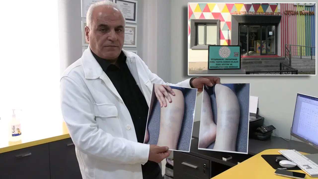 Torunu okulda şiddet gördü: Mağdur çocuklara destek birimi kurdu