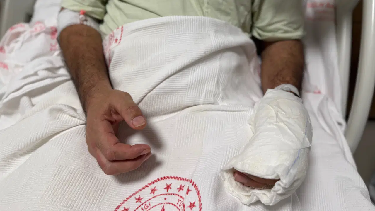 Sıcak torbası patlamasıyla vücudunun yüzde 30’u yandı: '5 dakika geçti, patladı'