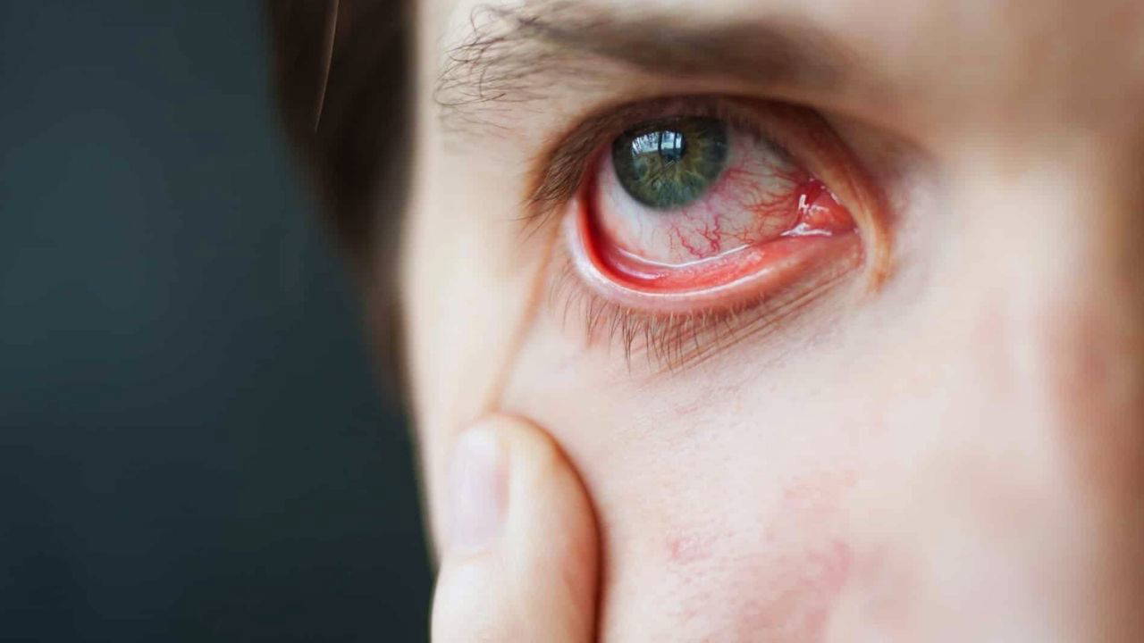 Ekrana bu kadar bakmayı bırakmanız gerekiyor!