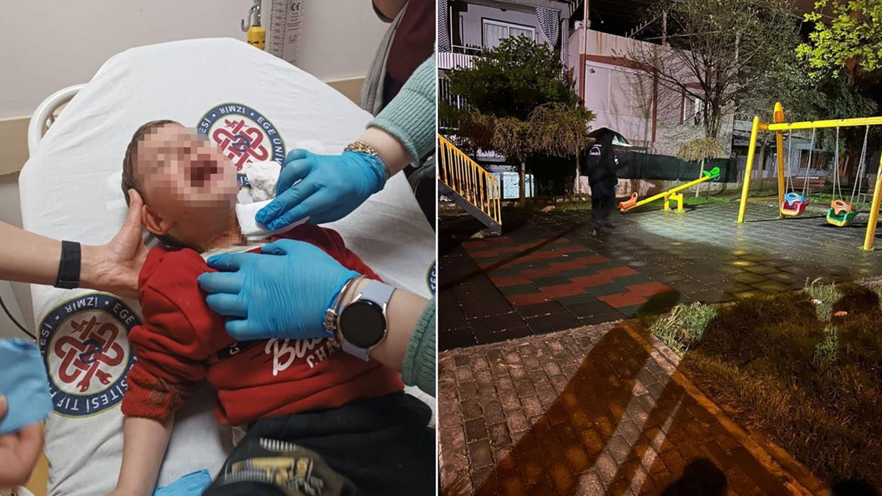 Korkunç olay... Parkta oynayan 2 yaşındaki çocuğa bıçakla saldırdı!