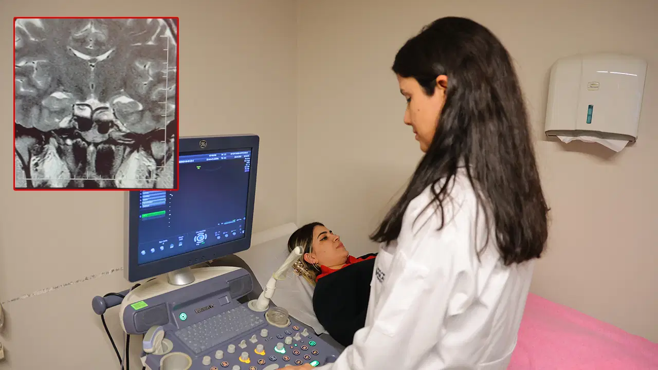 Gebelik belirtileriyle başvurdu, beyninden tümör çıktı: Kahramanmaraş’ta şaşırtan teşhis