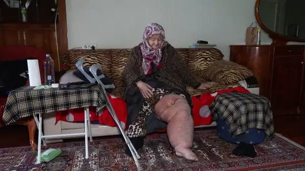  Fil hastalığıyla mücadele ederken oturduğu evin yıkılacağını öğrendi