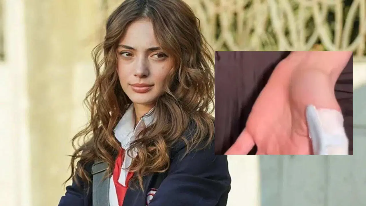 TRT dizisi setinde korkunç kaza! Rabia Soytürk’ün parmağı kopma noktasına geldi