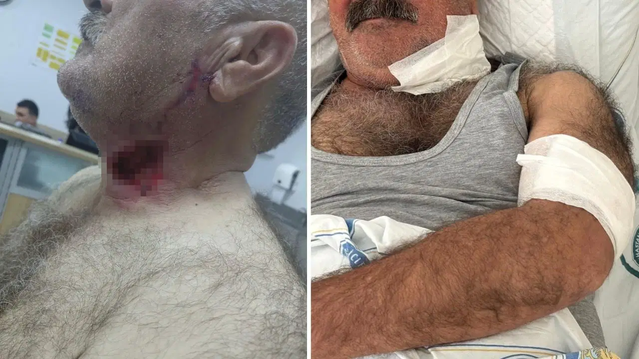 Atının saldırısına uğrayan kişi ölümden döndü: Üstünde tepindi, boğazından ısırdı