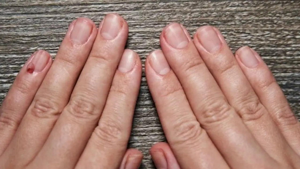 Ayak tırnağınızdaki o detaya dikkat: Sessizce yayılan kanserin habercisi olabilir!