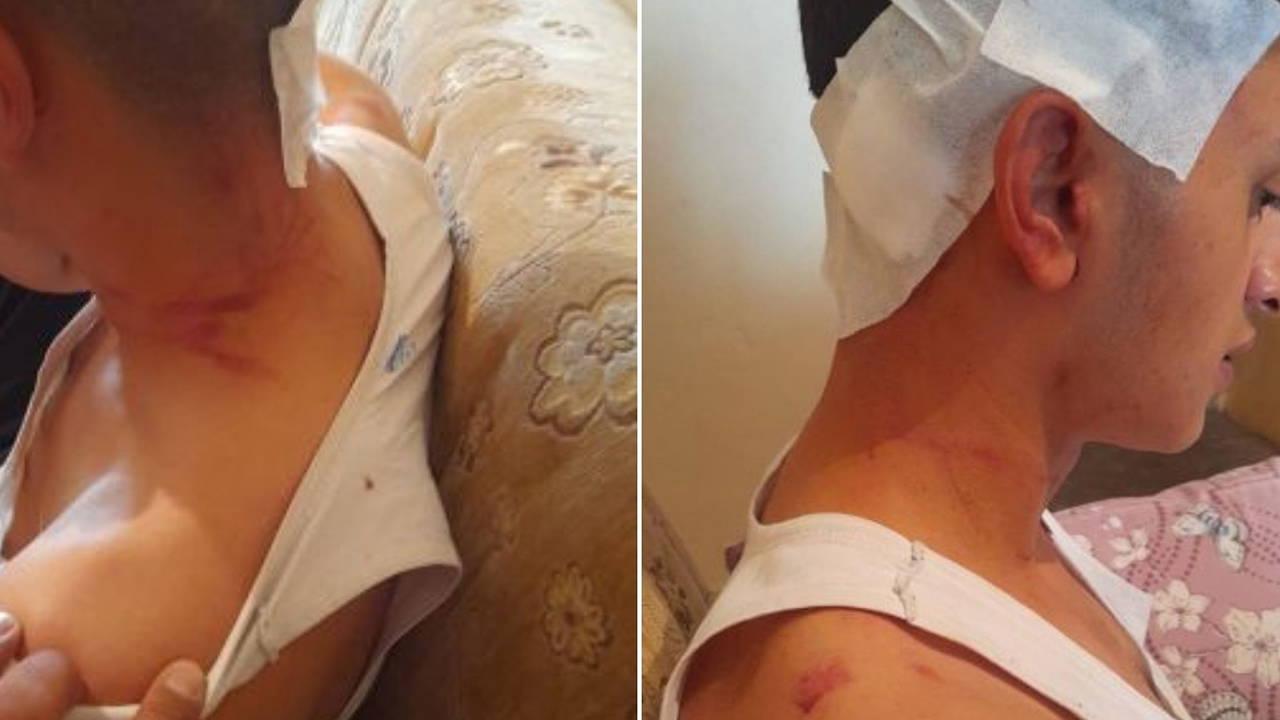 Kamera kayıtları kayıp: MHP’li başkanın oğulları hakkında 'darp' iddiası!